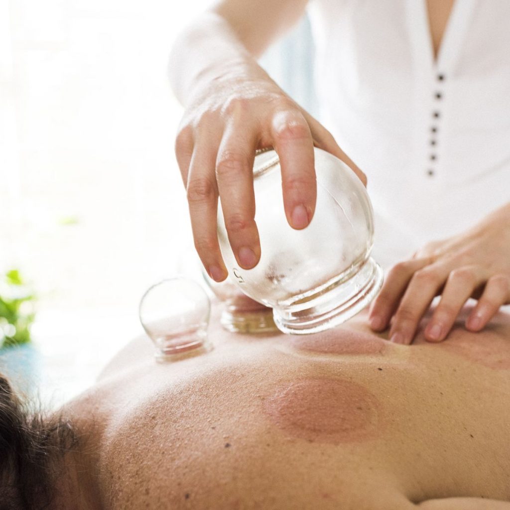 Lavan Acupuncture and Herbal Clinic Cupping therapist