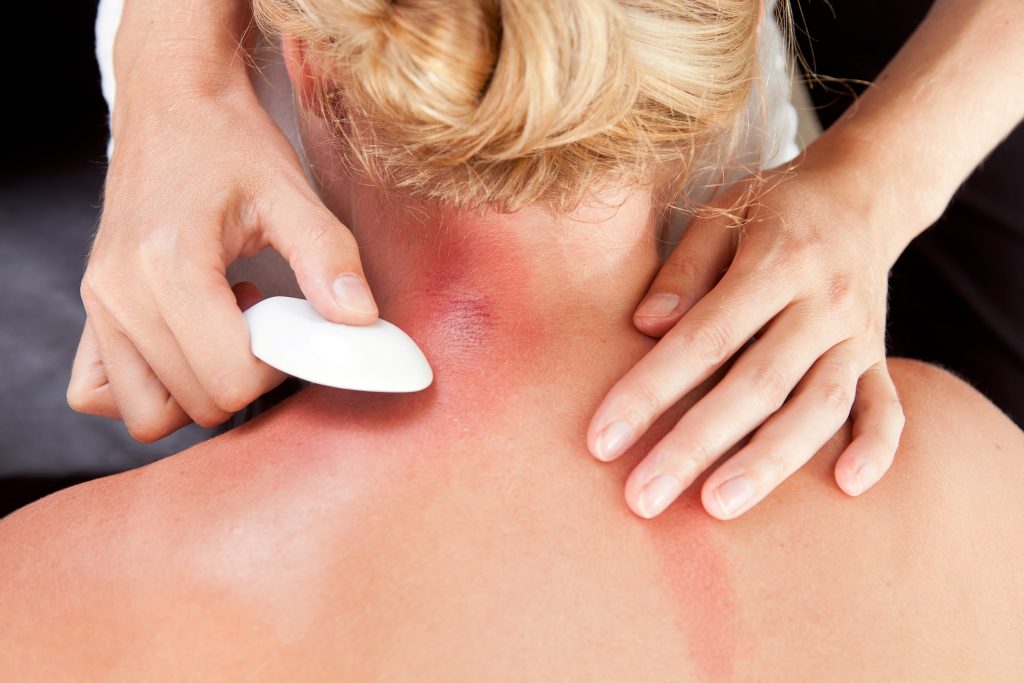 Lavan Acupuncture and Herbal Clinic Gua-sha treatment